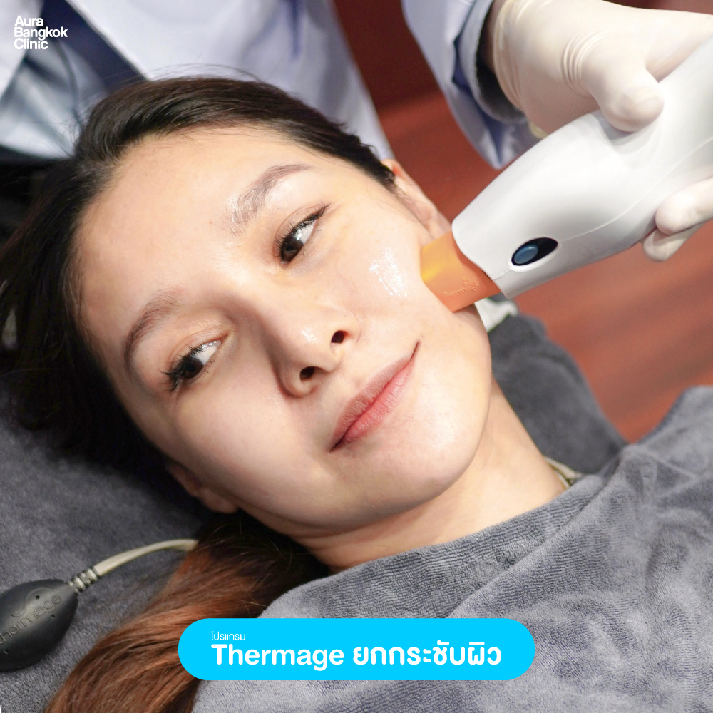 thermageรีวิว