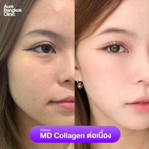 md collagen